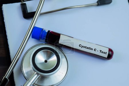 Cystatin C - Test mit Blutprobe auf Holzuntergrund. Gesundheitswesen oder medizinisches Konzept