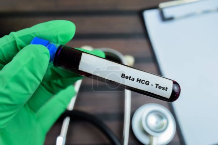 Beta HCG - Test with blood sample on wooden background. Healthcare or medical concept