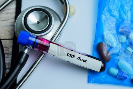 CRP - Test mit Blutprobe auf Holzuntergrund. Gesundheitswesen oder medizinisches Konzept