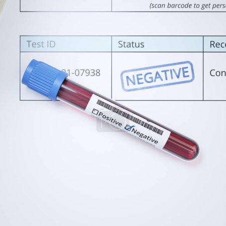 Photo for A tube of blood and medical documents. The negative result of the test. Lethal virus detection. HIV, AIDS, Corona, Coronavirus, flu. Hospital. Laboratory. Data protection. Lab. Scan a barcode. Blue. - Royalty Free Image
