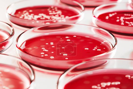 Photo for This captivating image showcases rows of Petri dishes containing bacterial colonies of Staphylococcus aureus or Streptococcus. Red blood agar plate used to diagnose infection. Microbiology, laboratory - Royalty Free Image
