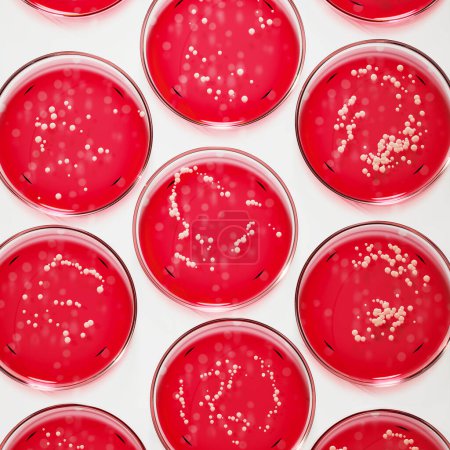 Foto de Esta cautivadora imagen muestra filas de platos Petri que contienen colonias bacterianas de Staphylococcus aureus o Streptococcus. Plato de agar rojo usado para diagnosticar infección. Microbiología, laboratorio - Imagen libre de derechos