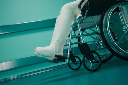 Foto de Foto detallada de la pierna de un individuo encerrada en un yeso blanco, colocada en el reposapiés metálico de una silla de ruedas, con un vibrante fondo azul-verde que enfatiza el contexto médico. - Imagen libre de derechos