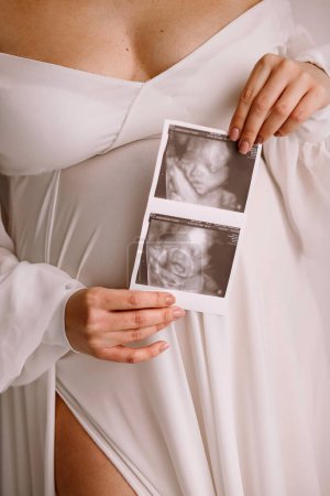 Close up photo of pregnant woman in white dress holding ultrasound picture. Woman expecting newborn. The concept of happy motherhood
