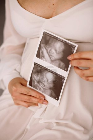 Close up photo of pregnant woman in white dress holding ultrasound photo. Woman expecting newborn. Happy motherhood concept