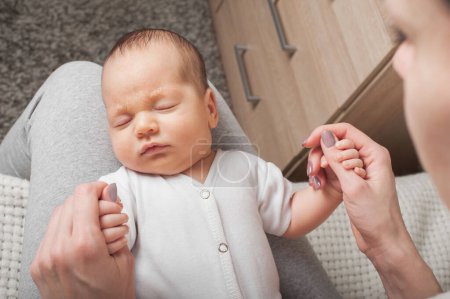 Foto de 1 month Newborn baby sleeping with atopic dermatitis in his mothers arms close-up. Newborn care concept - Imagen libre de derechos