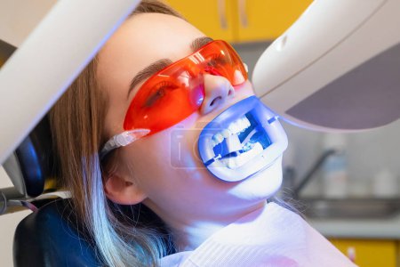 UV lamp shines on the patiens teeth during teeth whitening at dentist clinic.