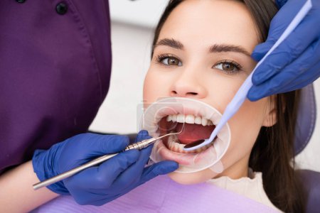 Patientin wird in Klinik zahnärztlich behandelt. Zahnärztin in Handschuhen überprüft mit speziellen Instrumenten akribisch die Stärke der Zähne