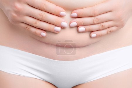 Photo for Woman belly with a scar from a cesarean section. Motherhood and childbirth - Royalty Free Image