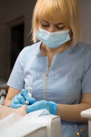 Podólogo en mascarilla facial durante el proceso de extracción de una uña encarnada. 