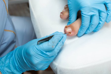Podologist making medical pedicure in beauty salon