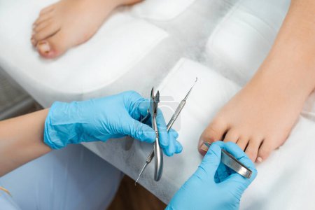 Professionelle medizinische Fußpflege mit speziellen Nagelinstrumenten in der Klinik