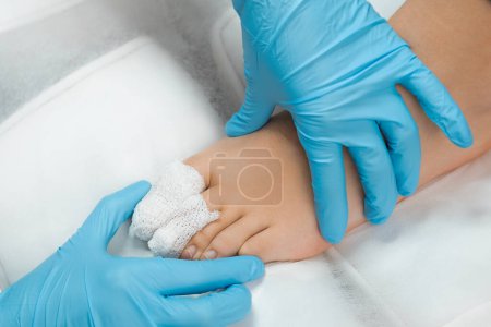 Cerrar los dedos vendados de un paciente después del tratamiento con podólogo. 
