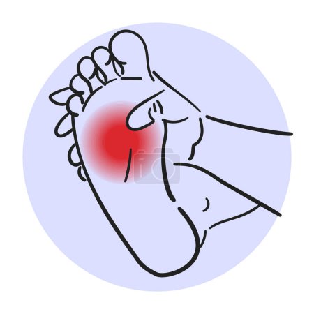 Ilustración de Foot pain vector isolated. Medical illustration, physical injury, orthopedic disease. Problems with foot sole - Imagen libre de derechos