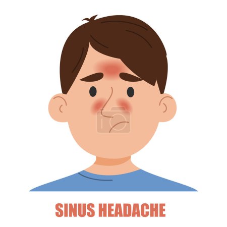 Illustration for Sinus headache vector isolated. Illustration of a man suffering from the headache caused by sinusitis or allergy. Nasal infection. Sad face. - Royalty Free Image