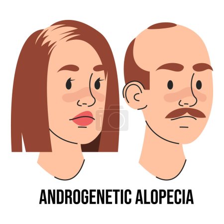 Illustration for Androgenetic alopecia vector isolated. Male and female character suffering from hair loss. Problems with health. Medical condition. - Royalty Free Image