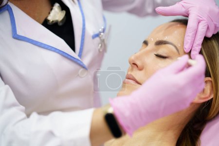 Foto de Pintura estética del médico en la cara de su paciente de mediana edad las áreas a tratar con toxina botulínica. - Imagen libre de derechos
