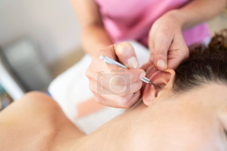 Crop professional chiropractor applying ear acupuncture techniques on female client lying in modern clinic during auriculotherapy treatment
