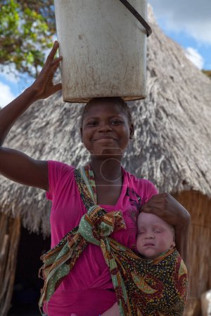 Téléchargez les photos : Souriant fière jeune femme africaine recueillant de l'eau dans des seaux et porté équilibré sur la tête avec enfant albinos endormi dans une capulana sur la hanche. Exemple d'albinisme. Contraste de couleur de peau. - en image libre de droit