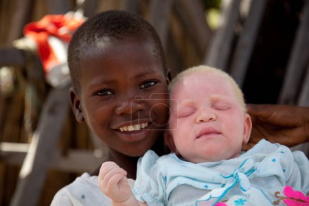 Téléchargez les photos : Jeune garçon noir non identifié tenant un enfant albinos à l'ombre. - en image libre de droit