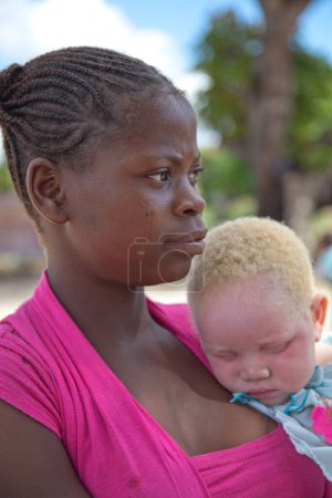 Téléchargez les photos : Jeune fille noire non identifiée tenant un enfant albinos à l'ombre. - en image libre de droit