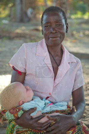 Téléchargez les photos : Xai Xai Mozambique : Femme s'occupant d'un enfant albinos assis à l'ombre d'un arbre tenant un enfant endormi. - en image libre de droit