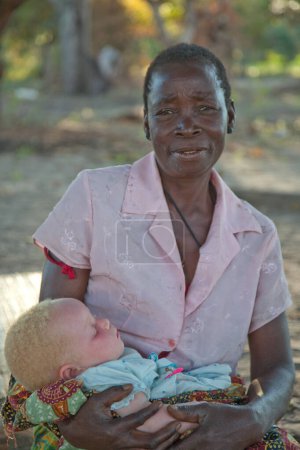 Téléchargez les photos : Souriant fière jeune femme africaine recueillant de l'eau dans des seaux et porté équilibré sur la tête avec enfant albinos endormi dans une capulana sur la hanche. Exemple d'albinisme. Contraste de couleur de peau. - en image libre de droit