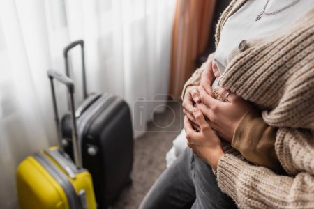 cropped view of man hugging woman near blurred travel bags in hotel apartments
