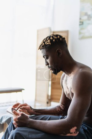 Side view of shirtless african american man with vitiligo using digital tablet while sitting on bed at home