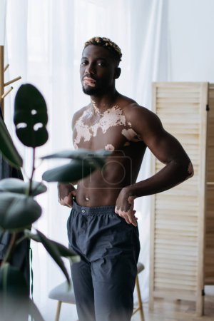 Shirtless african american man with vitiligo standing near plant at home