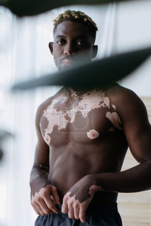 Muscular african american man with vitiligo looking at camera near blurred plant at home