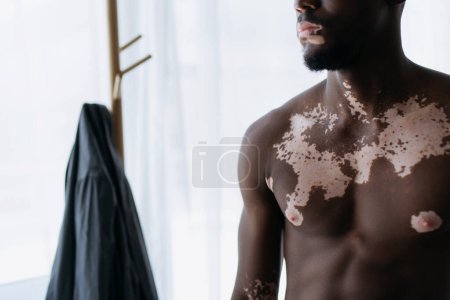 Cropped view of shirtless african american man with vitiligo standing near blurred floor hanger at home 