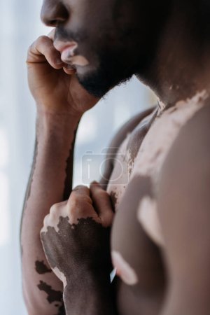 Cropped view of shirtless african american man with vitiligo standing at home  puzzle 652291050