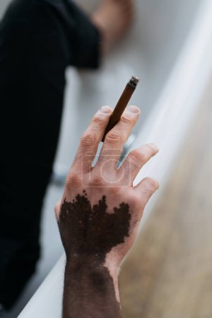 Vista recortada del hombre afroamericano con vitiligo sosteniendo cigarro en la bañera en casa 
