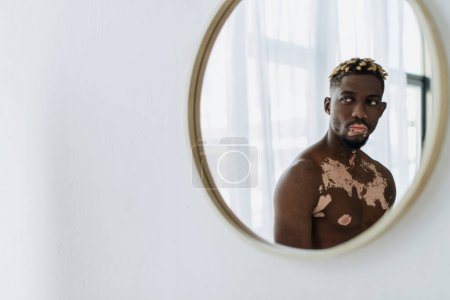 Shirtloser afrikanisch-amerikanischer Mann mit Vitiligo, der im Spiegel des modernen Badezimmers reflektiert 