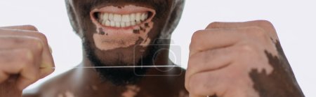 Photo for Cropped view of african american man with vitiligo smiling and holding dental floss at home, banner - Royalty Free Image