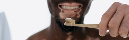 Foto de Vista recortada del hombre afroamericano sonriente con vitiligo sosteniendo cepillo de dientes en casa, pancarta - Imagen libre de derechos