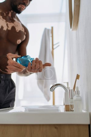 Foto de Vista recortada del hombre afroamericano con vitiligo sosteniendo loción aftershave en el baño - Imagen libre de derechos