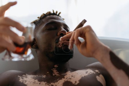 Foto de Joven afroamericano con vitiligo fumando cigarro y sosteniendo whisky borroso mientras toma un baño en casa - Imagen libre de derechos