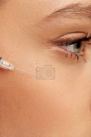 close up shot of syringe with hyaluronic acid or filler near face of young woman on grey background
