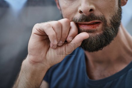 Foto de Vista recortada del hombre ansioso con barba mordiéndose los labios hasta la sangre durante el episodio depresivo - Imagen libre de derechos