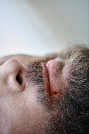 abgeschnittene Ansicht eines ängstlichen Mannes, der sich während einer depressiven Episode in die Lippen beißt, bis Blut fließt, psychische Gesundheit