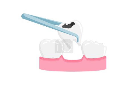 Illustration for Tooth extraction vector illustration. Toothache icon sign symbol - Royalty Free Image