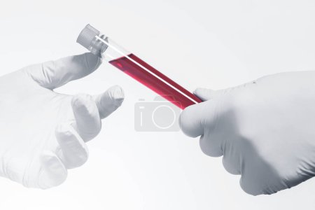 Foto de Vacante de muestra de sangre y mano de científico usando guantes de látex. Concepto de análisis de sangre o investigación. - Imagen libre de derechos