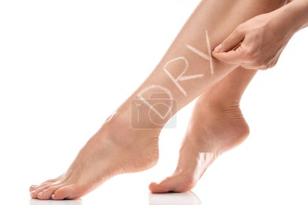 Téléchargez les photos : Gros plan des jambes féminines avec peau qui démange et lettrage sec sur elle sur fond blanc - en image libre de droit
