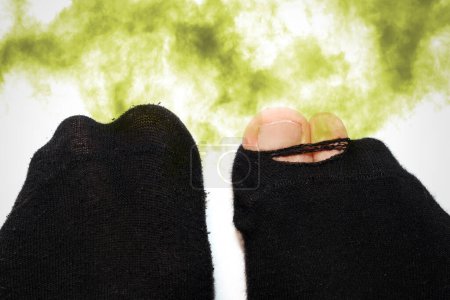 Téléchargez les photos : Gros plan de pieds masculins dans de vieilles chaussettes puantes et sales - en image libre de droit