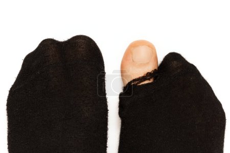 Closeup shot of male feet in old hoaly socks with a toe sticking out on white background. Concept of poverty and financial crisis.