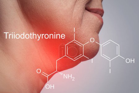 Photo for Female neck and triiodothyronine hormone formula produced by thyroid - Royalty Free Image