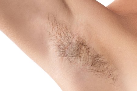 Photo for Closeup of hairy female armpit. Concepts of health and hygiene. - Royalty Free Image
