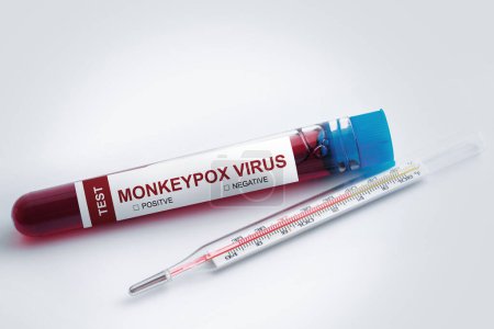 Téléchargez les photos : Aspirateur avec échantillon de sang de variole du singe pour les tests sur fond gris - en image libre de droit